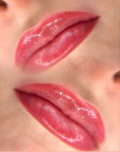 Lippen Pigmentierung